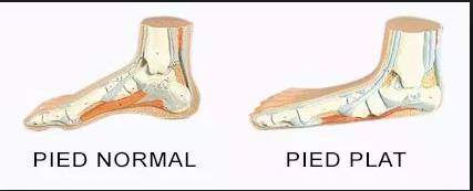 Comment choisir ses chaussures de trail quand on a les pieds plats